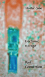 Normal USB X-ray image appears clear, precise and well defined